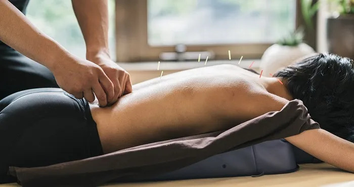 Can Acupuncture Help With Addiction? Exploring Benefits And Effectiveness
